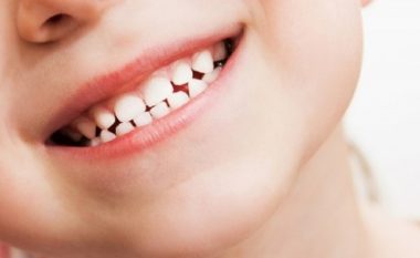 ​“Vizitat e fëmijëve para moshës 3 vjeçare te dentisti të bëhen të detyrueshme”