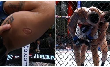 Dalin pamjet shokuese se si Lima kafshohet nga Severino – ky i fundit eliminohet direkt nga UFC