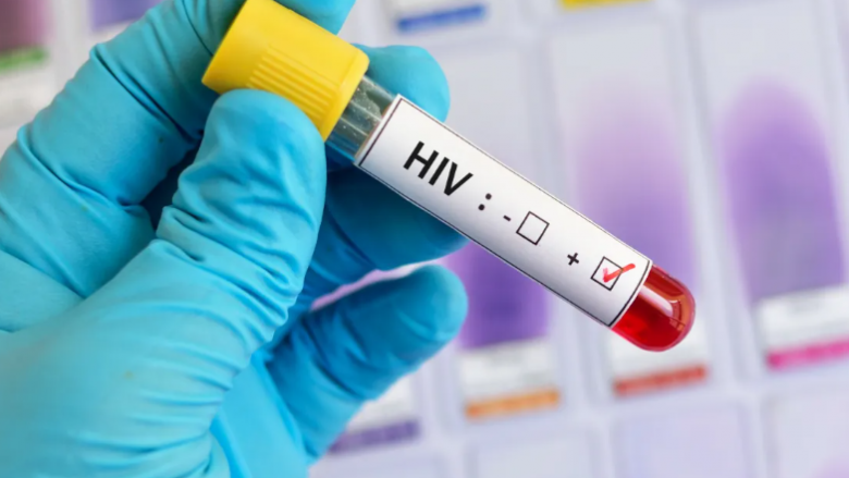 Në QKUK nis dhënia e terapisë për parandalimin e infeksionit nga virusi HIV