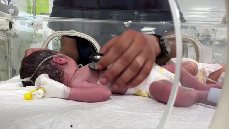 Mjekët shpëtojnë foshnjën 7 muajshe nga barku i palestinezes së vdekur, shtëpia e tyre u bombardua nga izraelitët në Rafah