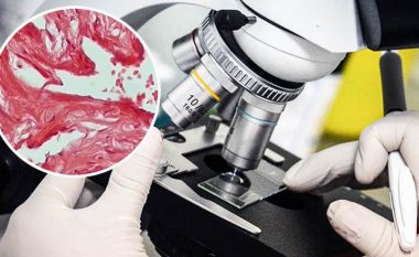 Si duket organi gjenital mashkullor në mikroskop? Mjeku tregoi prerjen, ai përbëhet nga tri pjesë