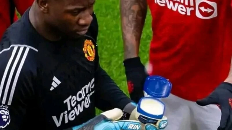 Tifozët vunë re një detaj të çuditshëm: Pse portieri i United i lyen dorezat me vazelinë