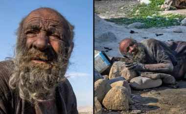Historia e trishtueshme e njeriut që nuk është pastruar për 60 vjet – mjekja tregon se pse besohet se ai e shmangu ujin e sapunin