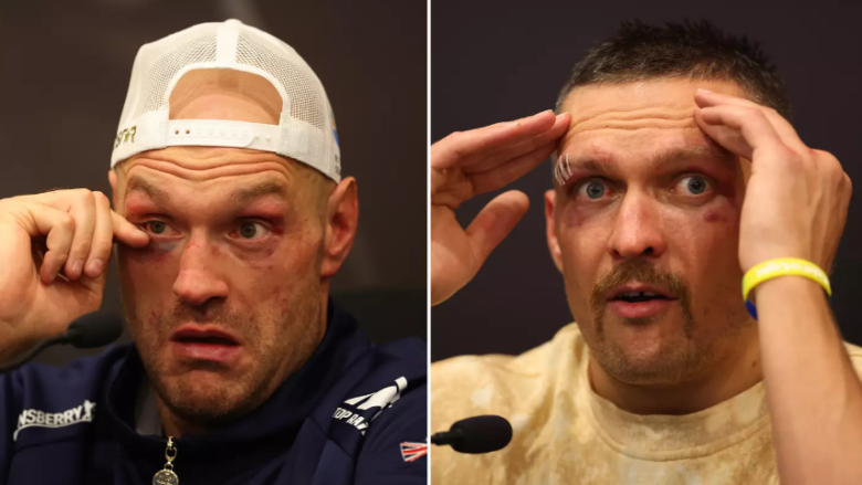 Tyson Fury dhe Oleksandr Usyk humbasin miliona euro shkaku i adhuruesve të boksit