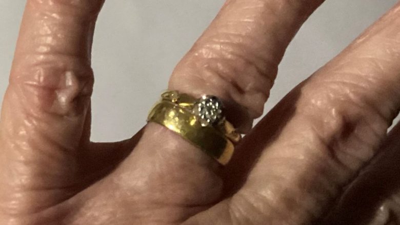 Gruaja britanike ‘mbeti pa fjalë’ pasi gjeti unazën e fejesës të cilën e kishte humbur 54 vjet më parë