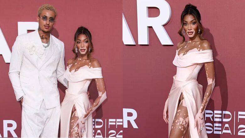 Winnie Harlow dukej magjepsëse me një fustan rozë, ndërsa sjell të dashurin Kyle Kuzma në ‘amfAR Gala’ në Kanë