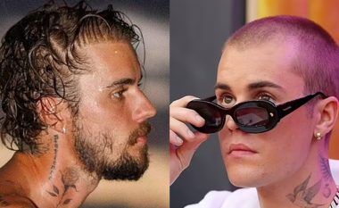 A është kjo provë që Justin Bieber kishte një transplant flokësh? - Kirurgu i famshëm zbulon shenjat e habitshme