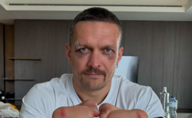 Oleksandr Usyk shfaq lëndimet që ka pësuar në duar nga grushtimi i Tyson Furyt
