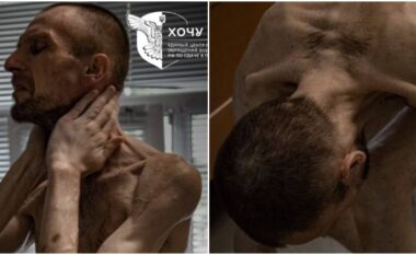 Pas dy vjetësh si rob lufte në qelitë ruse - Roman Gorylyk në gjendje të rëndë fizike