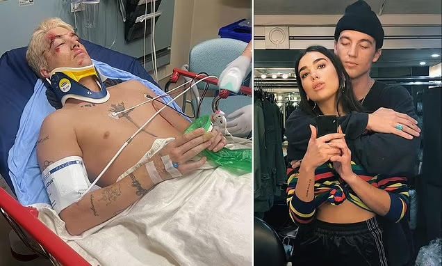 Ish-i dashuri i Dua Lipës, Paul Klein përfundon në spital pas një aksidenti të rëndë me veturë: Jam me fat që jam ende gjallë