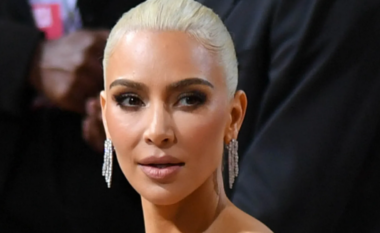 Kim Kardashian tregon se një nga djemtë e saj të vegjël ka vitiligo