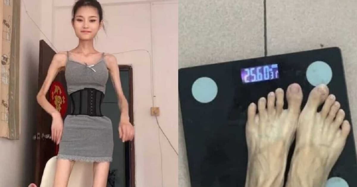 Influencuesja kineze Baby Tingzi peshon vetëm 25 kilogramë, ndjekësit i luten që të kërkojë ndihmë mjekësore
