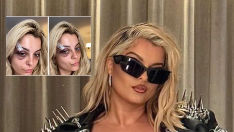 Mori trauma nga fansat, Bebe Rexha i paralajmëron gjatë koncertit në Norvegji: Mos luani me mua