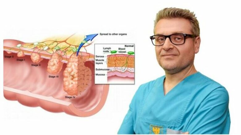 Intervistë me Doc. Dr. Andrej Nikolovski: Shfaqja e gjakut në jashtëqitje, kapsllëku, jashtëqitja e lëngshme, dhimbje barku në formë prerjeje, fryrja e barkut janë simptoma të kancerit të zorrës së trashë