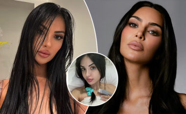 Modelja që shpenzoi miliona dollarë në kirurgji plastike për t’u dukur si Kim Kardashian, rrezikon të humbë mundësinë për të ngelur shtatzënë