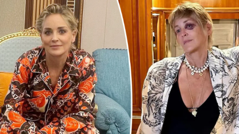 Shfaqet me sy të nxirë në një nga fotografitë e fundit, aktorja Sharon Stone shqetëson fansat