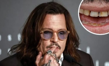 Më në fund: Johnny Depp rregullon dhëmbët