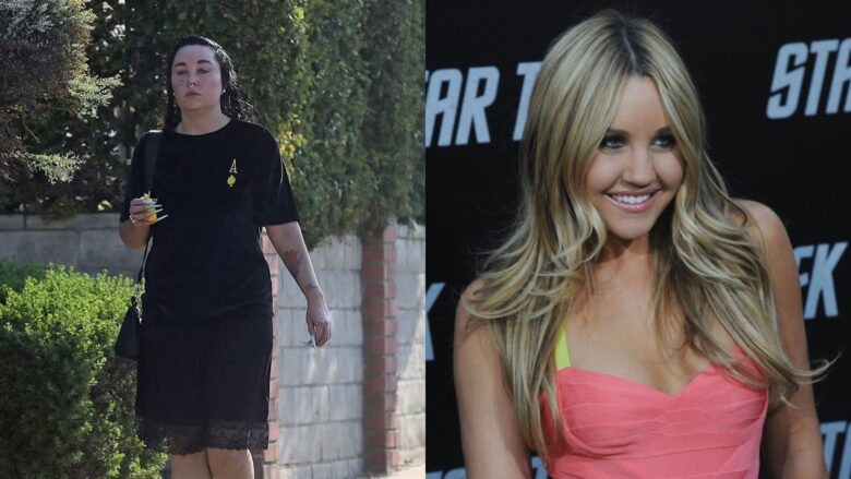 Ndryshimi drastik i aktores amerikane Amanda Bynes