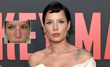 Halsey vuan nga shpërthimi i lupusit pas performancës së VMA-së