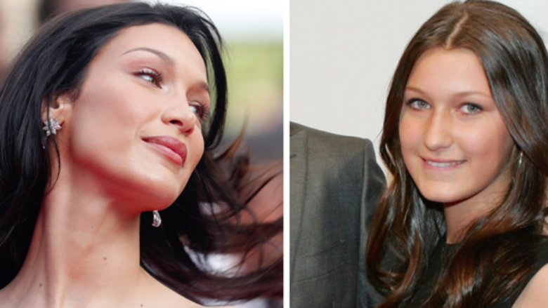 U shpall një nga femrat më të bukura në botë, por si dukej Bella Hadid para operacioneve plastike