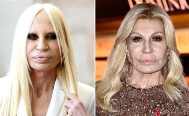 Kirurgu plastik ka zbuluar se çfarë i ka bërë fytyrës Donatella Versace: “Nuk e përjashtoj mundësinë e protezës së mjekrës dhe kjo është e sigurt”