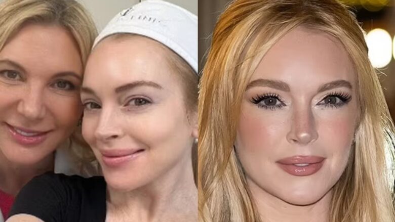 Lindsay Lohan pozon pa make-up, pas transformimit të saj të diskutueshëm