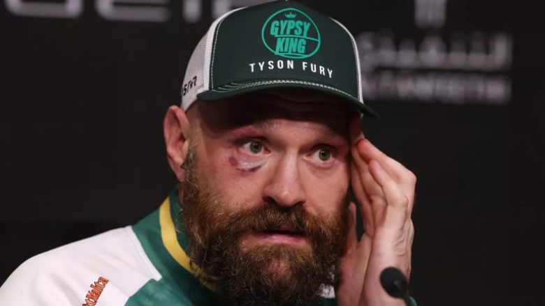 Tyson Fury do të bëjë ‘njoftim serioz’ vetëm disa javë pasi doli në pension