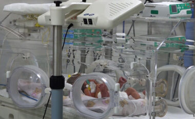 ​Skeningu neonatal për herë të parë në Kosovë