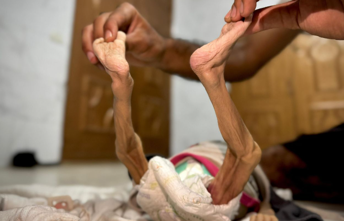 Vdes nga uria foshnja 6-muajshe palestineze – nëna zemërthyer publikon pamjet ‘asht e lëkur’ të së bijës